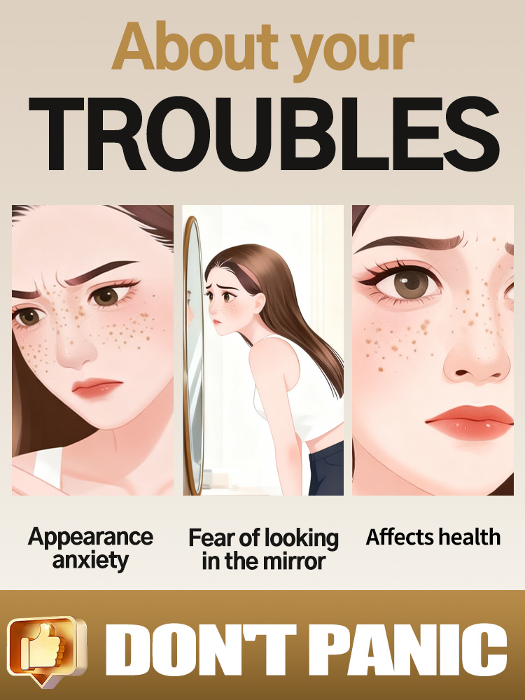 Lightening Facial Freckles Mel - Luxury Natural Skincare review and price