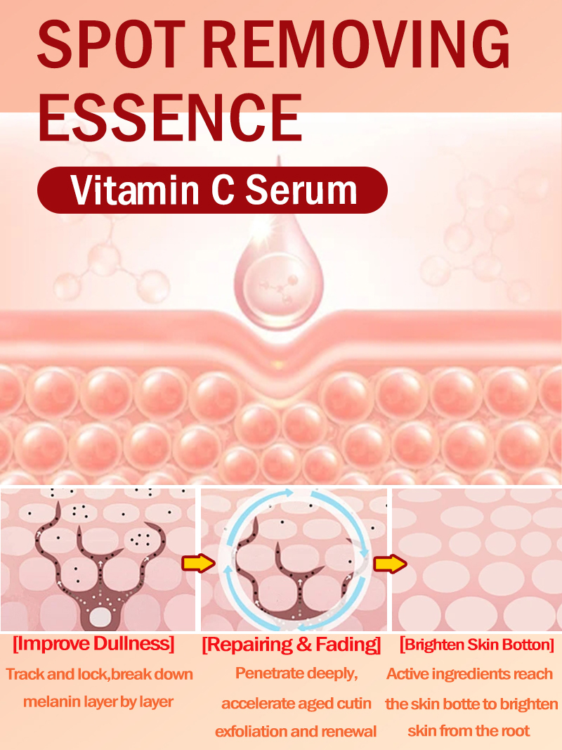 Lighten Freckles Melasma, Faci - Luxury Natural Skincare review and price